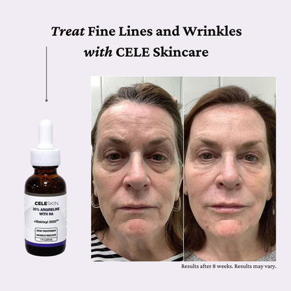 CELESkin™ No-Tox Line Erase Serum